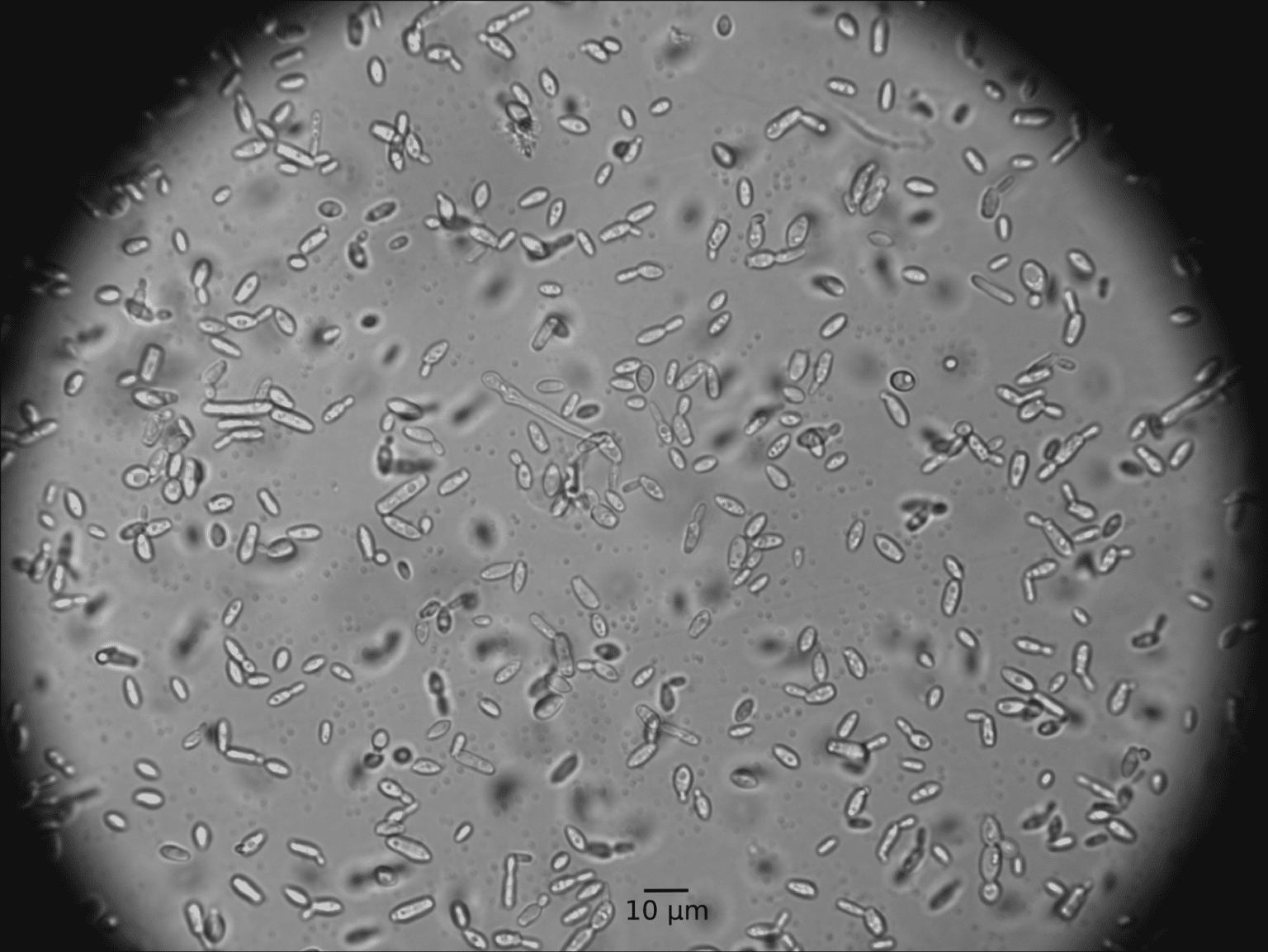 What Is Brettanomyces? (2023) WinePros